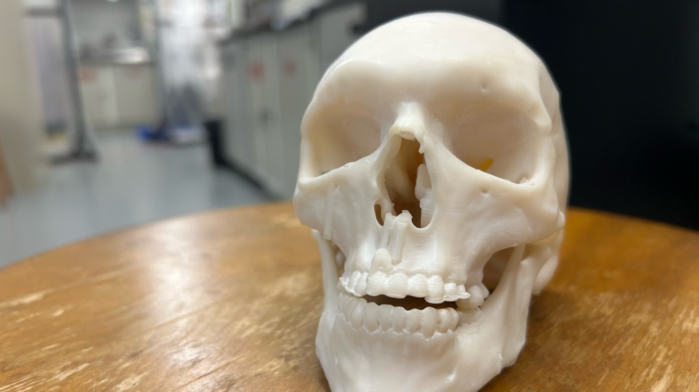 3d skull bone university waterloo bioengineering 1 7050463 1727214446372