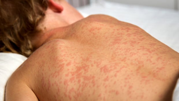 1770061800 877 default