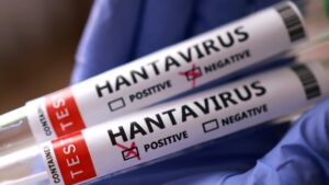Hantavirus Concerns Minimal in Windsor-Essex Area
