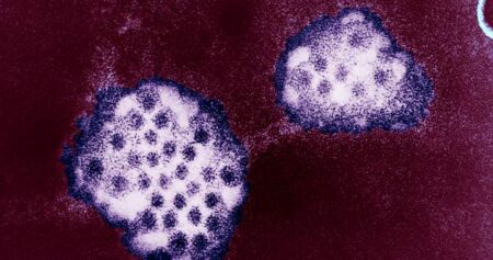 Kingston Health Officials Alert on Rising Stomach Illness Cases