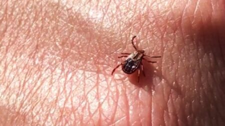 Health Unit Urges Outdoor Tick Checks in Guelph Area Health Unit Urges Outdoor Tick Checks in Guelph Area