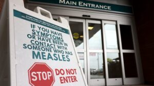 Measles Exposure Alert in Vaughan and Toronto Measles Exposure Alert in Vaughan and Toronto
