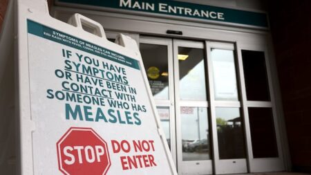 Measles Exposure Alert in Vaughan and Toronto Measles Exposure Alert in Vaughan and Toronto