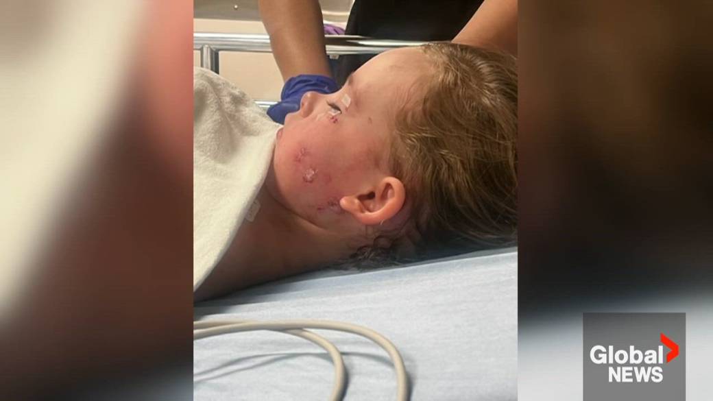 Click to play video: 'Oshawa, Whitby review pet ownership bylaws after dog mauling injures 4-year-old girl'