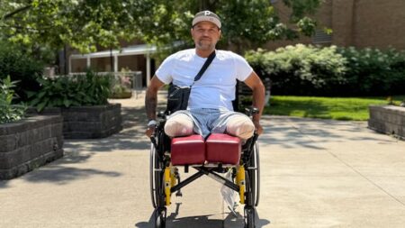London Man Faces New Journey After Losing Both Legs London Man Faces New Journey After Losing Both Legs