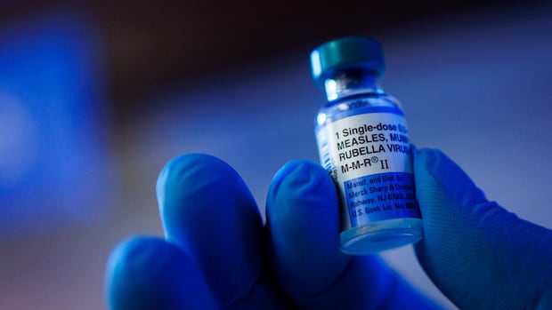 Health Alert: Measles Exposure at Local Spots Health Alert: Measles Exposure at Local Spots